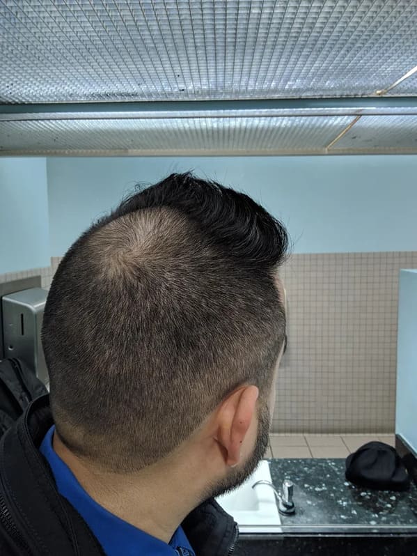 Funny bad haircuts, justfuckmyshitup, reddit r fuckmyshitup, barbers, hairdresser fails, funny terrible hairstyles