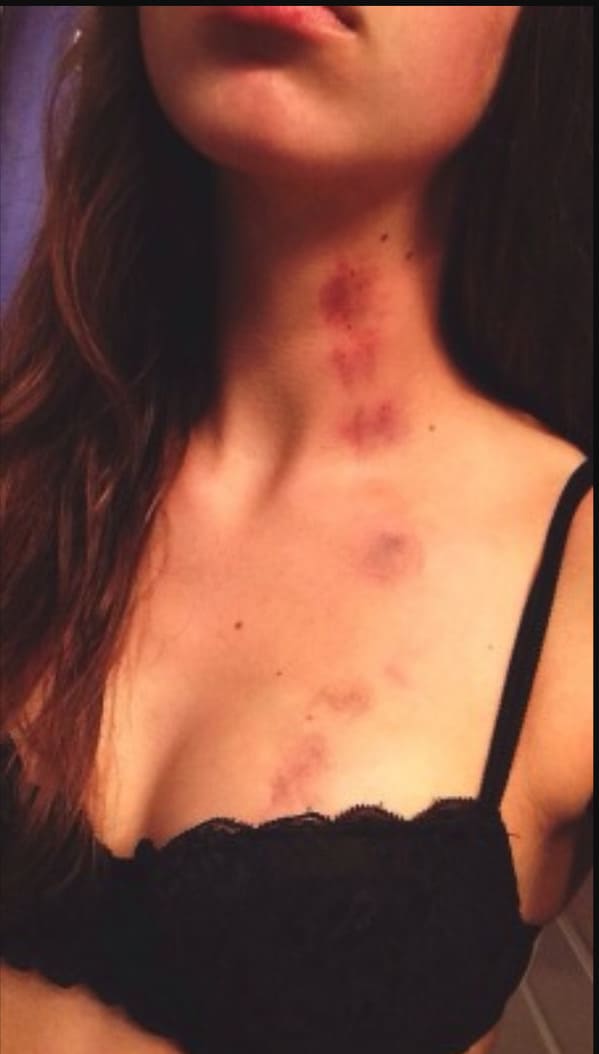 hickies on womans neck, weird tumblr